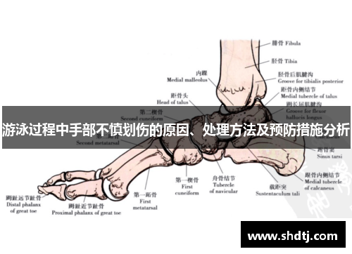 游泳过程中手部不慎划伤的原因、处理方法及预防措施分析